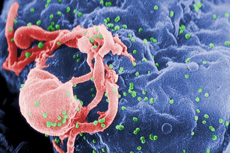 Ραγδαία εξάπλωση του HIV στην Ευρώπη