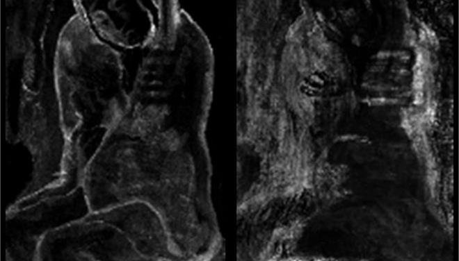 Ερευνητές ανακάλυψαν κρυμμένο έργο κάτω από πίνακα του Πικάσο