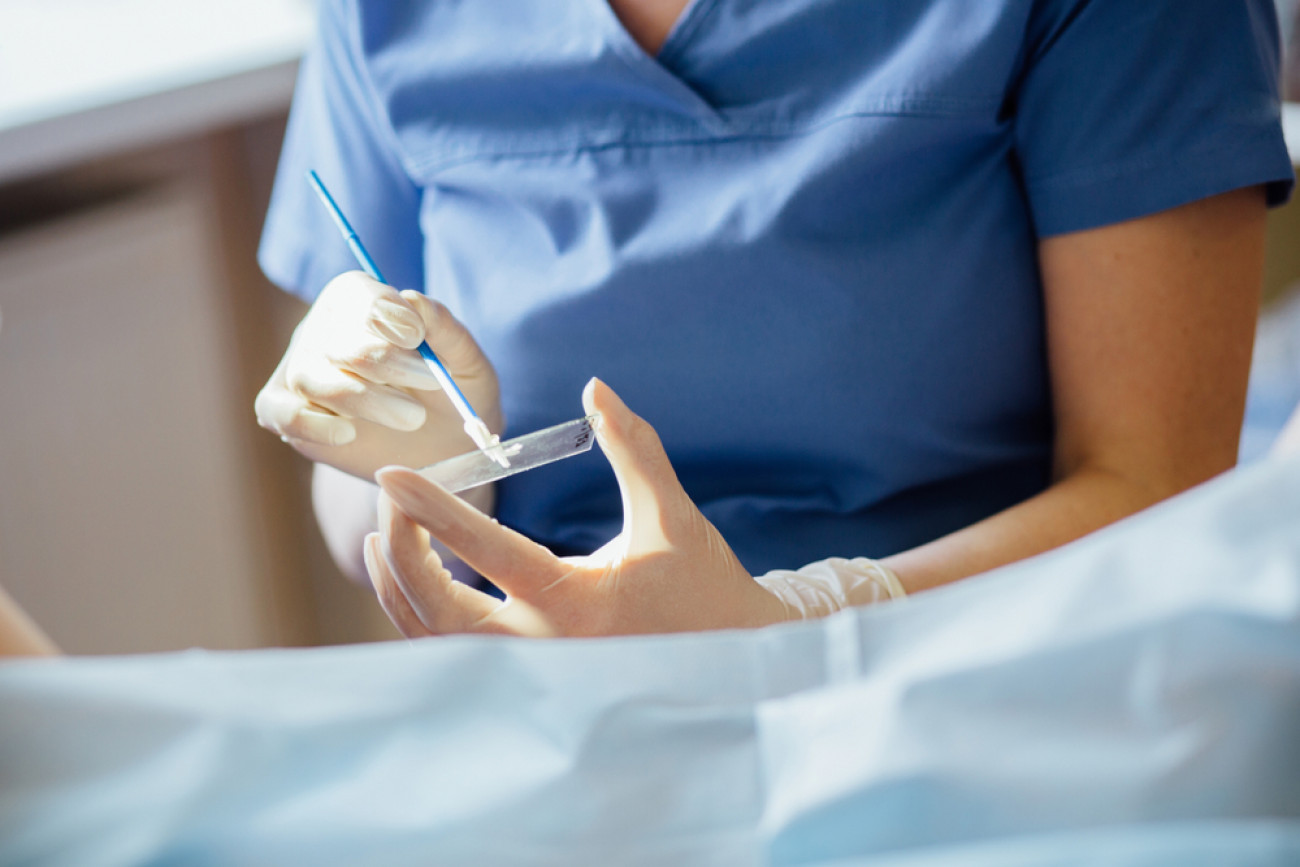 Το τεστ HPV «σκοτώνει» το τεστ Παπ