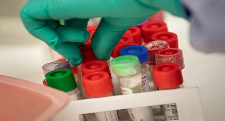 Χλωροκίνη: Παλιό φάρμακο για την ελονοσία και πώς δρα κατά του κορωνοϊού