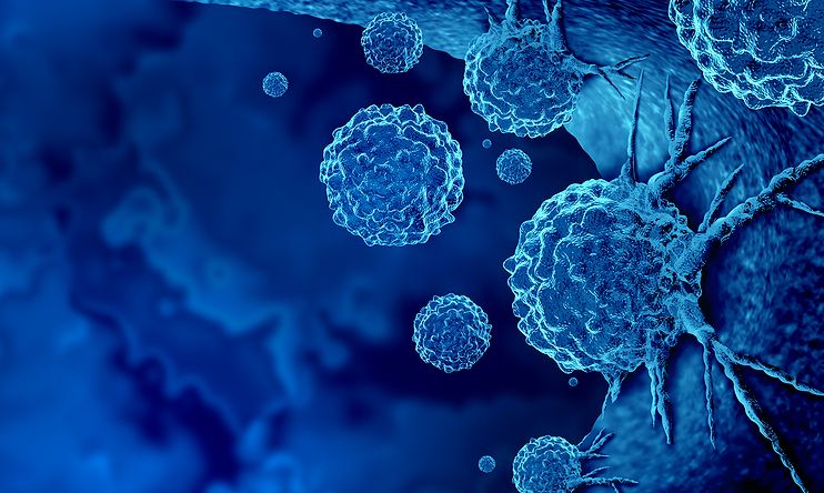 Επιστήμονες τροποποίησαν τα ανοσοποιητικά κύτταρα ασθενών ώστε να στοχεύουν τον συγκεκριμένο καρκίνο τους