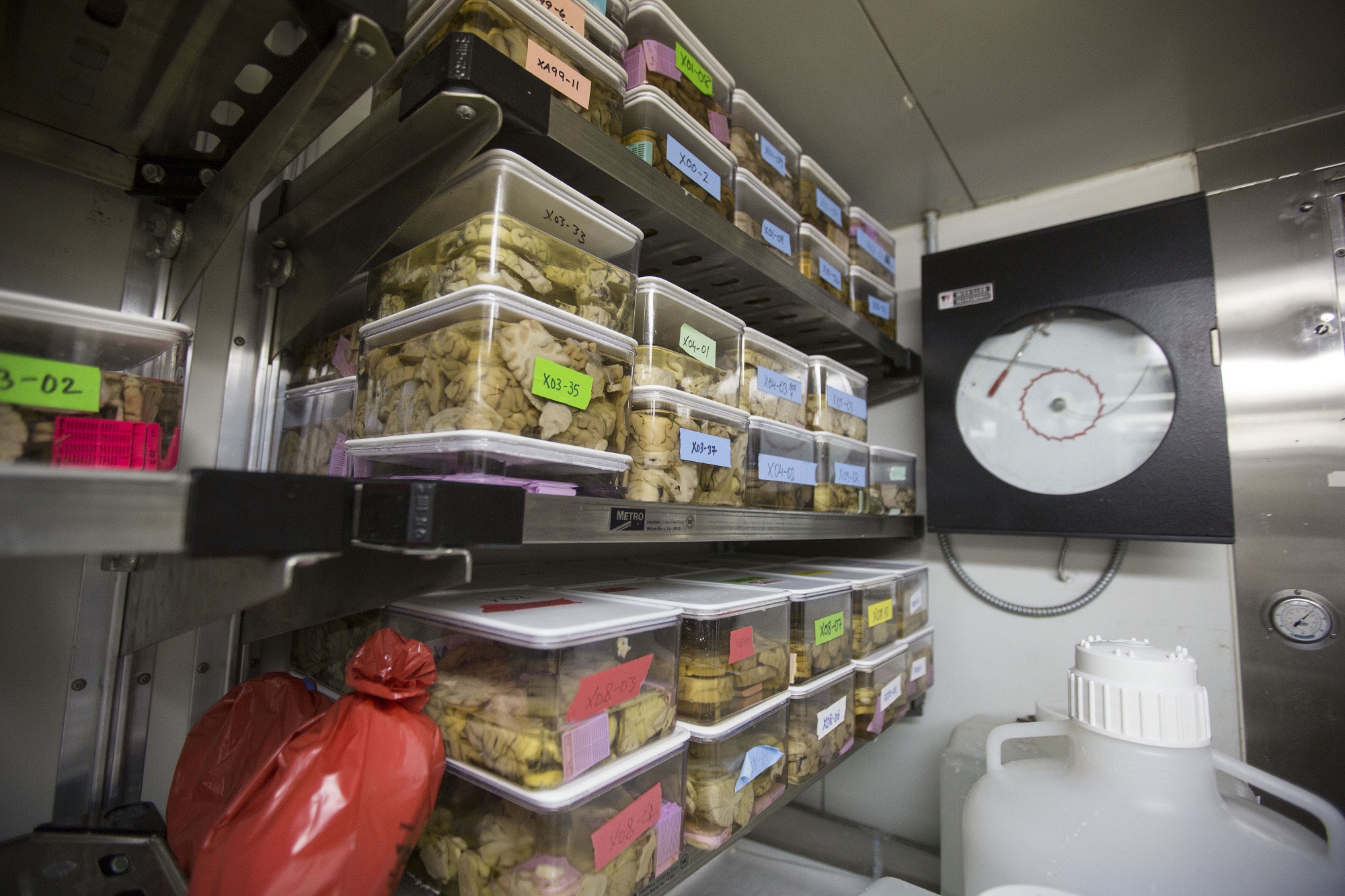 Η μεγαλύτερη συλλογή «φαιάς ουσίας» στον πλανήτη -Δέκα χιλιάδες εγκέφαλοι αποθηκευμένοι σε δοχεία