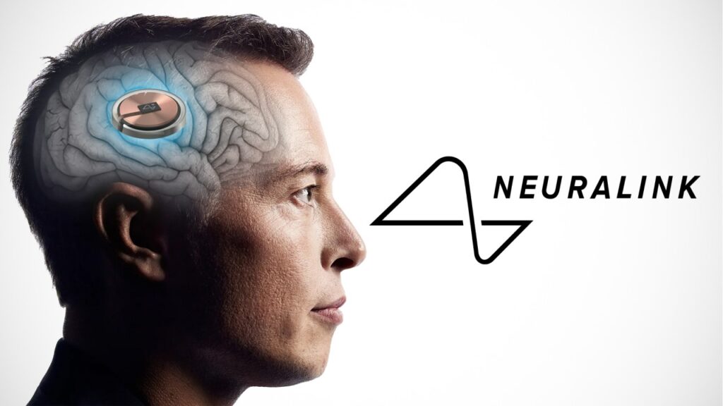 Έλον Μασκ για εμφύτευμα Neuralink: Θα κάνει τους παράλυτους να περπατήσουν