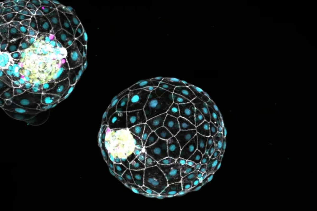 Επιστήμονες ανακάλυψαν έναν μηχανισμό που επιβραδύνει την ανθρώπινη ανάπτυξη