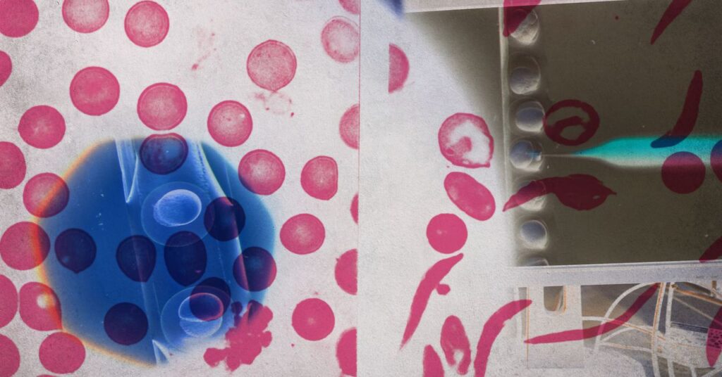 Crispr: Η επανάσταση της γονιδιακής θεραπείας που δεν μπορεί να μείνει προνόμιο λίγων