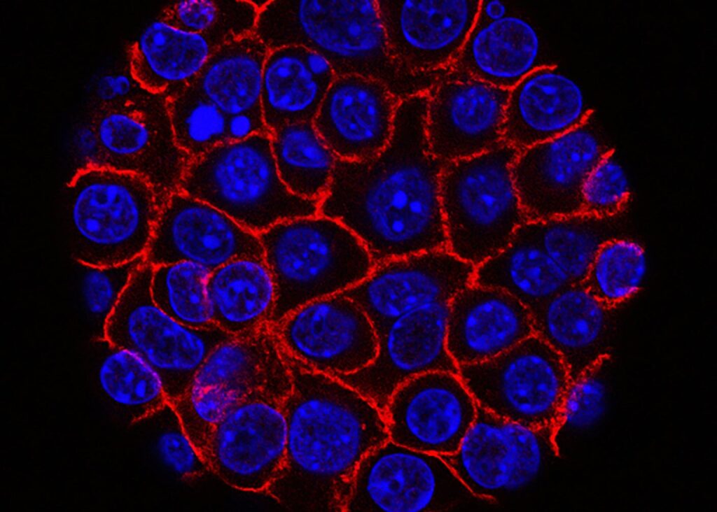 Τα υπερ-ανοσοκύτταρα που εξαφάνισαν τους συμπαγείς όγκους σε ποντίκια