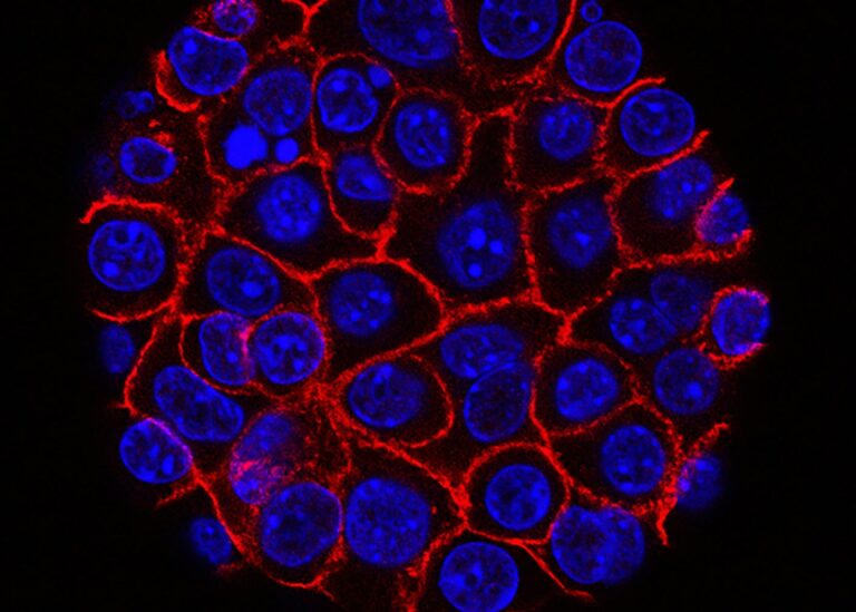 Τα υπερ-ανοσοκύτταρα που εξαφάνισαν τους συμπαγείς όγκους σε ποντίκια