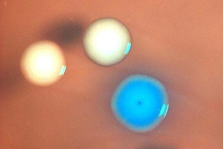 Νεκρά βακτήρια ξαναζούν: η πρώτη συνθετική κυτταρική ανάσταση