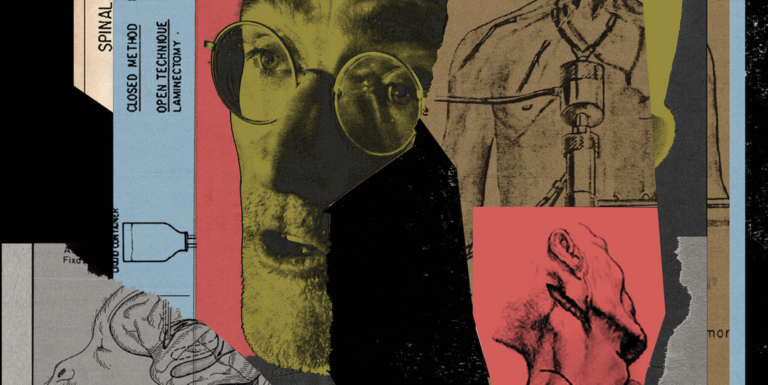 Ο χειρουργός που θέλει να κάνει μεταμόσχευση κεφαλιού — και να αποδείξει ότι ο θάνατος είναι προαιρετικός