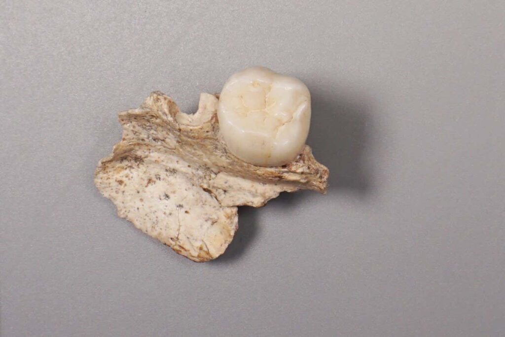Αρχαία δόντια δείχνουν σύνδεση Denisovans και Homo erectus