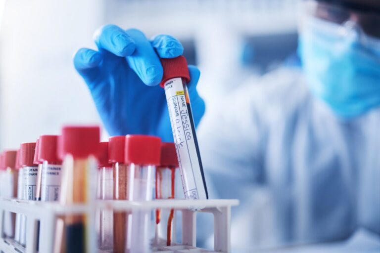 Το «βιολογικό ρολόι» του αίματος μπορεί να κρύβει περιστατικά αναιμίας