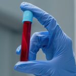 Νέα μελέτη αμφισβητεί τη νηστεία πριν από τις αιματολογικές εξετάσεις